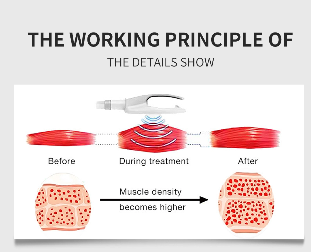 Electromagnetic Weight Loss Muscle Building EMS Pulse Magnetic Therapy Machine